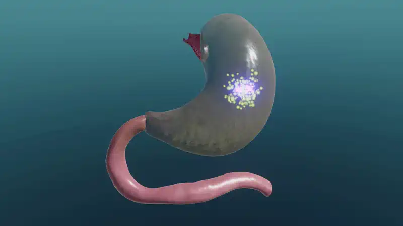 Structure and function of the stomach